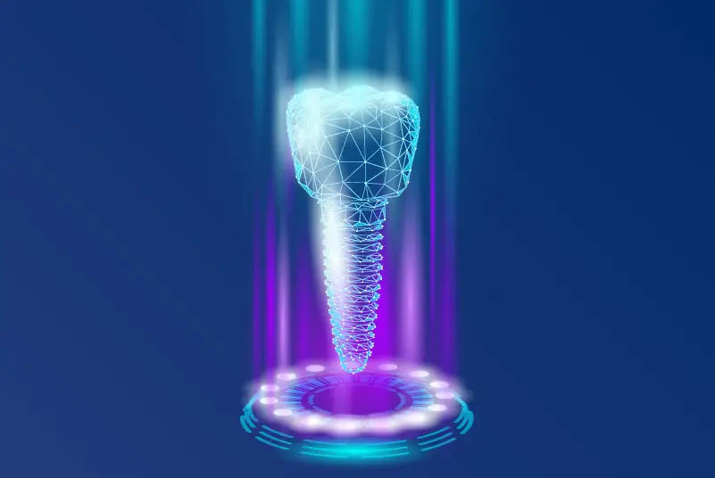 Dental Implant inside a ring of light